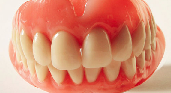 Zahnprothese: Im Dienst der Krone